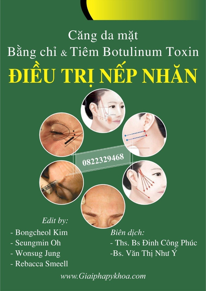 Sách căng da mặt bằng chỉ và tiêm BOTULINUM TOXIN điều trị nếp nhắn