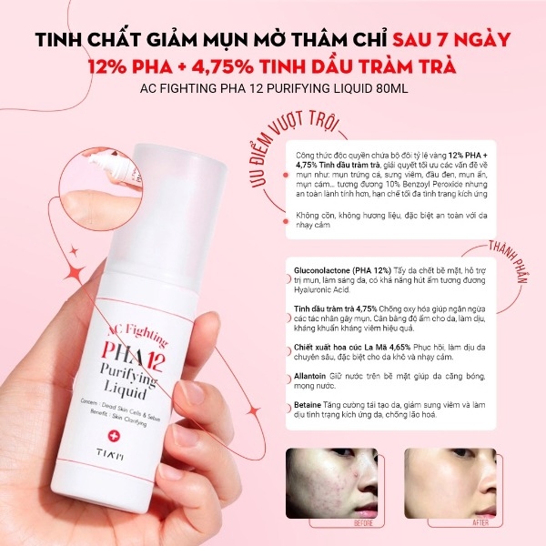 Tinh Chất Tia’m AC Fighting PHA 12 Purifying Liquid Giảm Mụn, Mờ Thâm 80ml