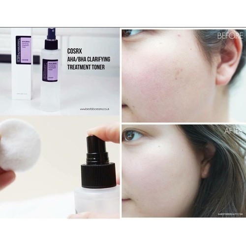 Nước Hoa Hồng COSRX Chứa AHA / BHA Tẩy Tế Bào Chết Làm Sáng Da Giảm Mụn 150ml