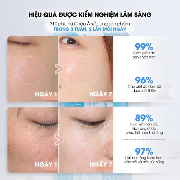 Serum Neogen Dermalogy Cấp Nước, Phục Hồi 3 Tác Động Real Hyal Panthenol 5% 31g
