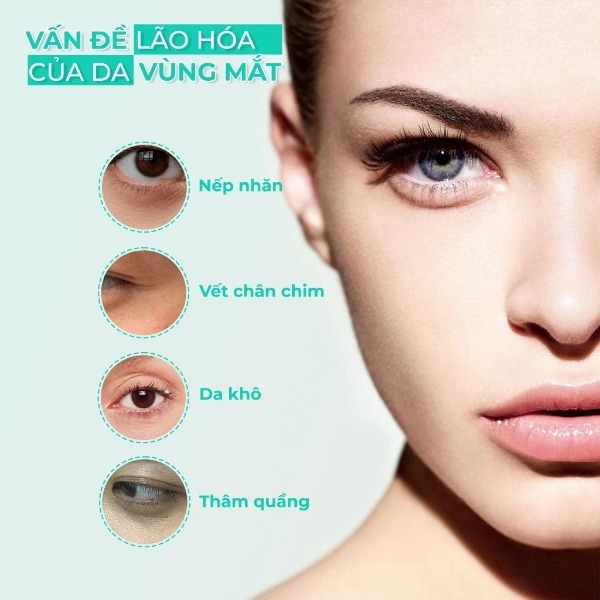 Kem Dưỡng Mắt Tia'm Vita A Bakuchiol Firming Eye Cream Giảm Nếp Nhăn, Mờ Quầng Thâm 30ml