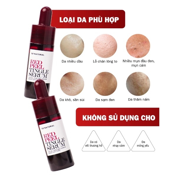 Tinh Chất So Natural Red Peel, Tinh Chất Tẩy Da Chết, Tinh Chất Dưỡng Sáng 11ml/35ml