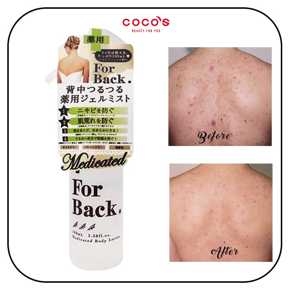 Xịt Giảm Mụn Lưng Pelican For Back Medicated Body Lotion Giúp Da Ẩm Mịn Trắng Sáng 100ml