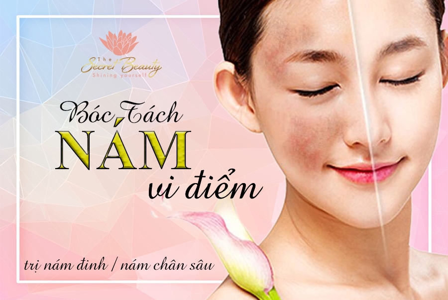 Spa Điều Trị Thâm Nám Hiệu Quả Hóc Môn