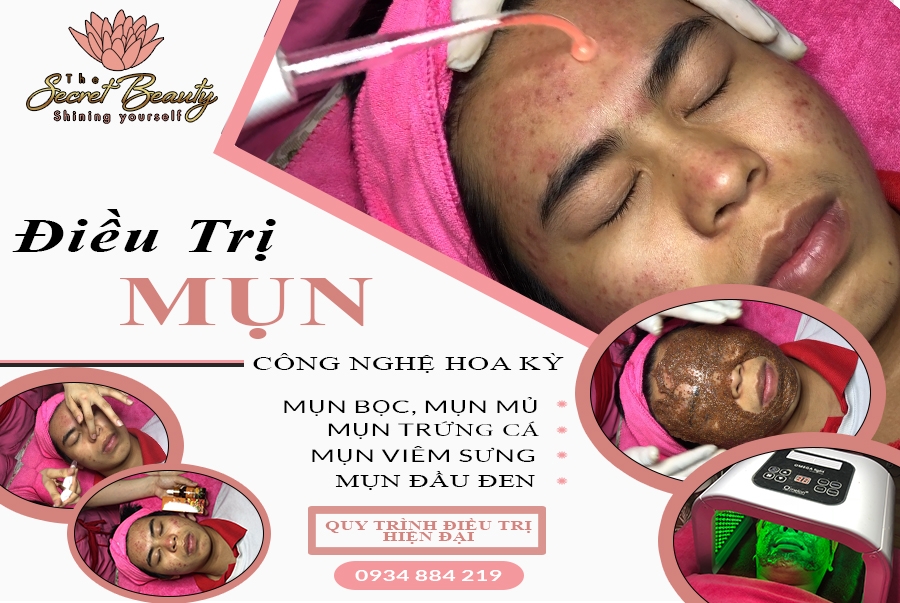 Spa Điều Trị Mụn Hiệu Quả Hóc Môn