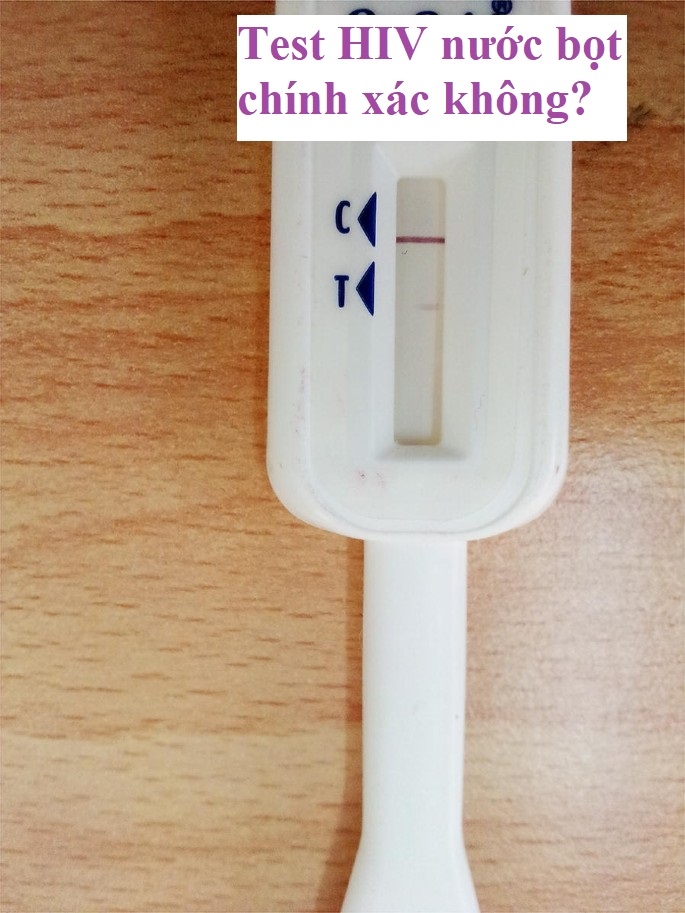Test nhanh HIV bằng nước bọt chính xác không?