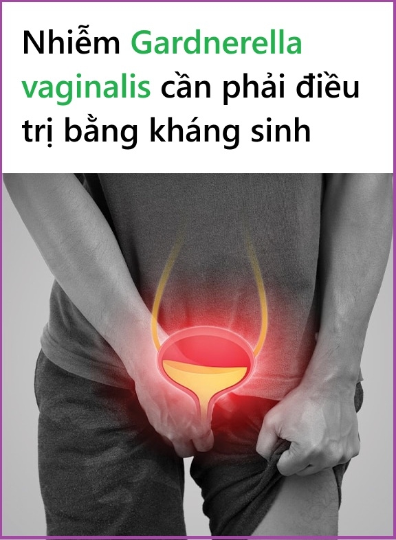 Nhiễm Gardnerella vaginalis sau khi quan hệ tình dục không an toàn phải làm sao?