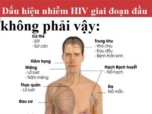 Triệu chứng mới nhiễm HIV không phải vậy?