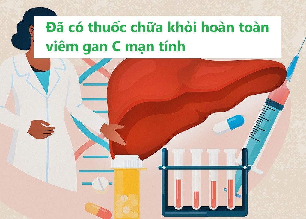 Có thuốc chữa khỏi hoàn toàn viêm gan C không?