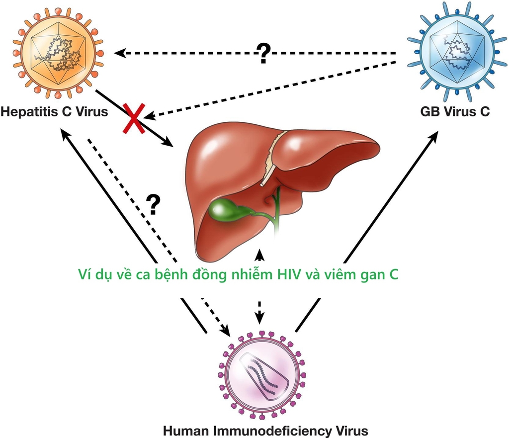 Ví dụ ca bệnh đồng nhiễm HIV và viêm gan C