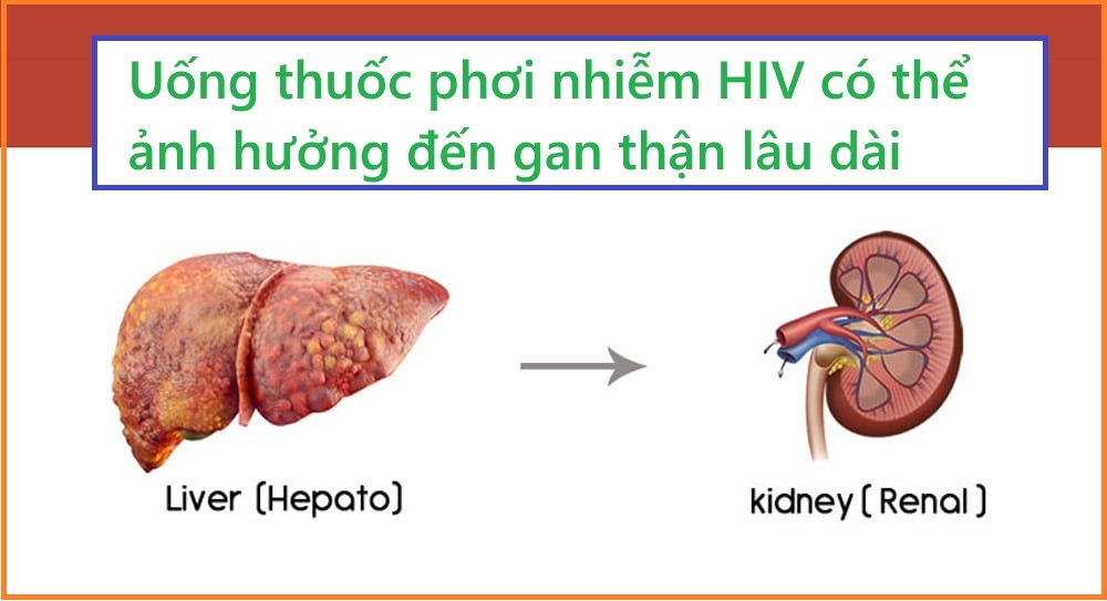 Uống thuốc phơi nhiễm HIV có sợ ảnh hưởng gì không?