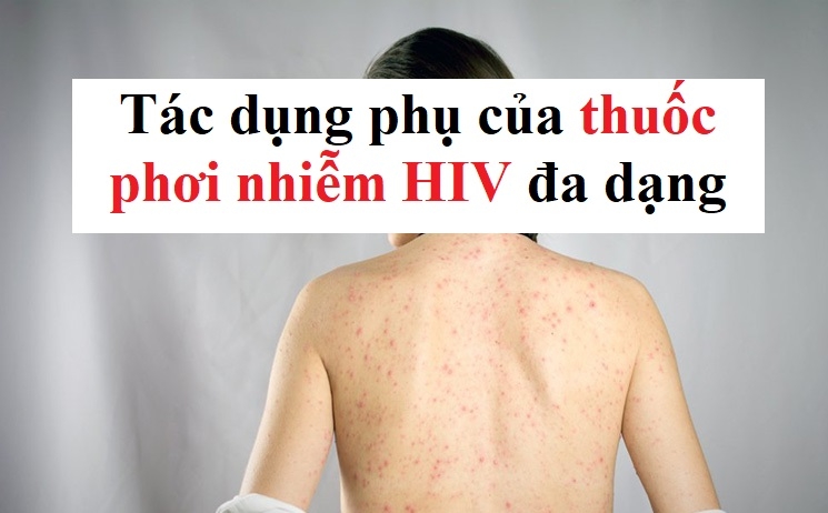 Tác dụng phụ của thuốc phơi nhiễm HIV là gì?