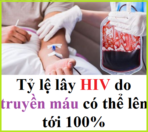 Ai là người dễ bị mắc HIV nhất?