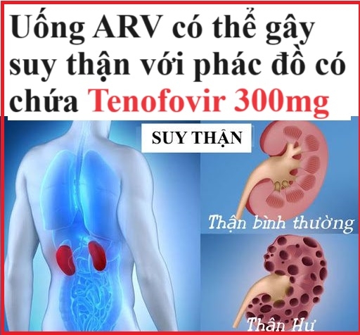 Uống ARV có gây suy thận không?