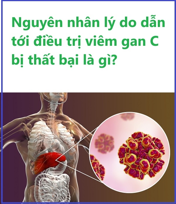 Nguyên nhân điều trị viêm gan C bị thất bại? Chẩn đoán và giải pháp khắc phục?