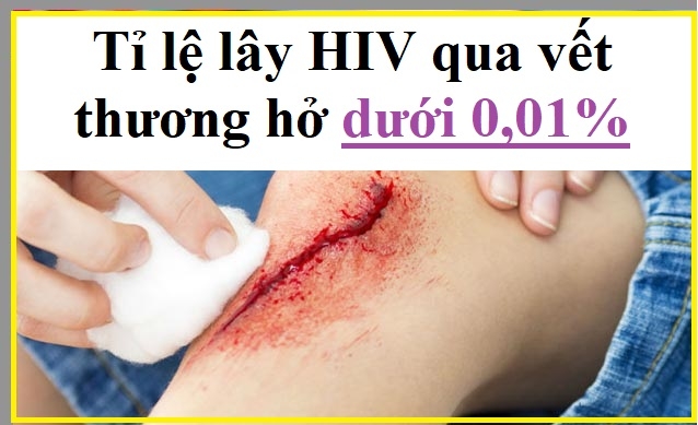 Tỷ lệ lây HIV qua vết thương hở có cao không?
