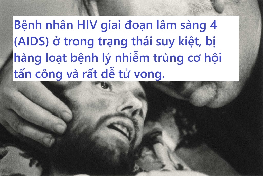 Triệu chứng của nhiễm HIV giai đoạn lâm sàng 4 sẽ như thế nào?