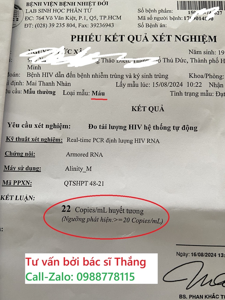 Xét nghiệm đo tải lượng HIV là gì? Cách làm và ý nghĩa thực tiễn?