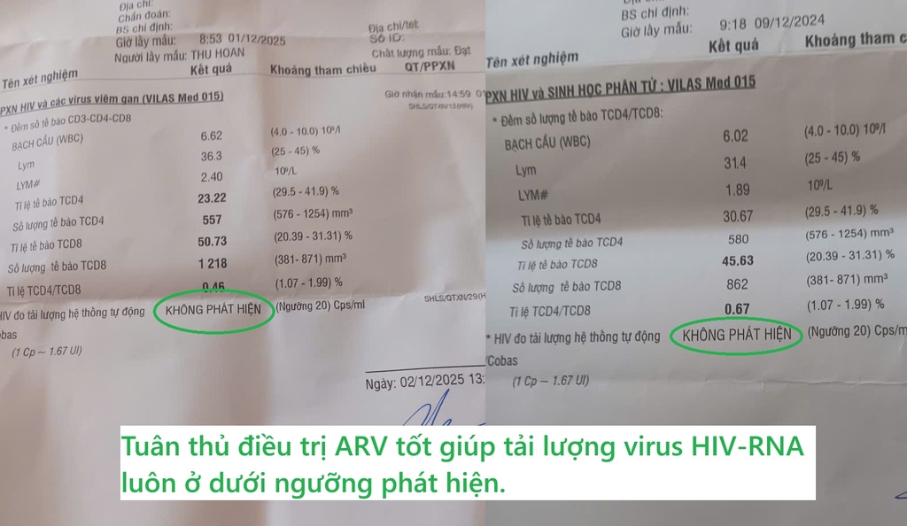 Tuân thủ điều trị ARV tốt giúp tải lượng HIV-RNA vẫn duy trì dưới ngưỡng phát hiện