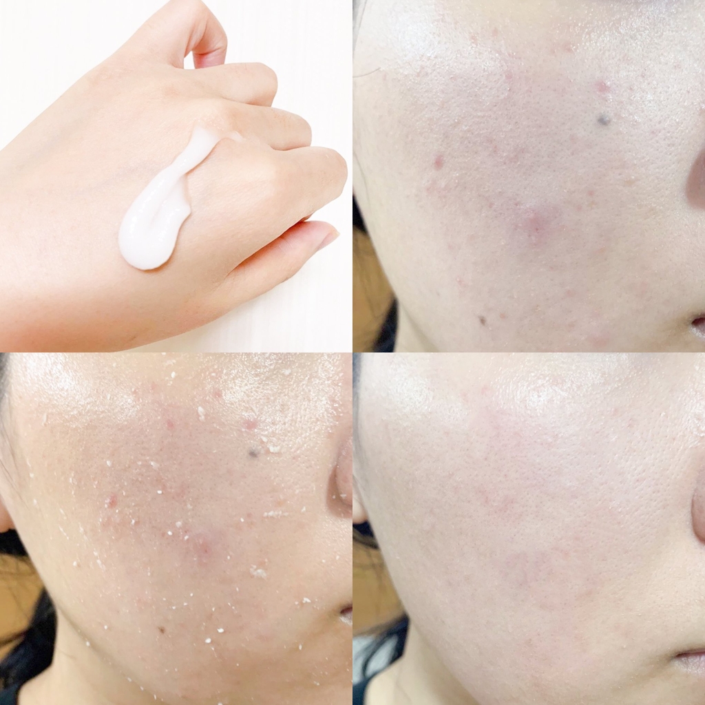 Missha Aqua Ultra Hyalron Peeling Gel 100ml SonAuth Official