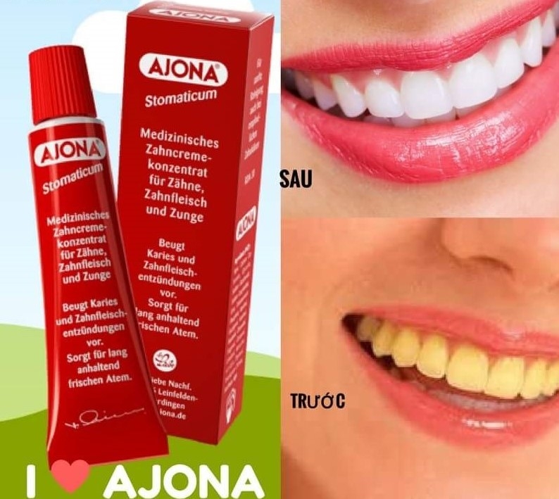 Kem Đánh Răng Ajona Stomaticum