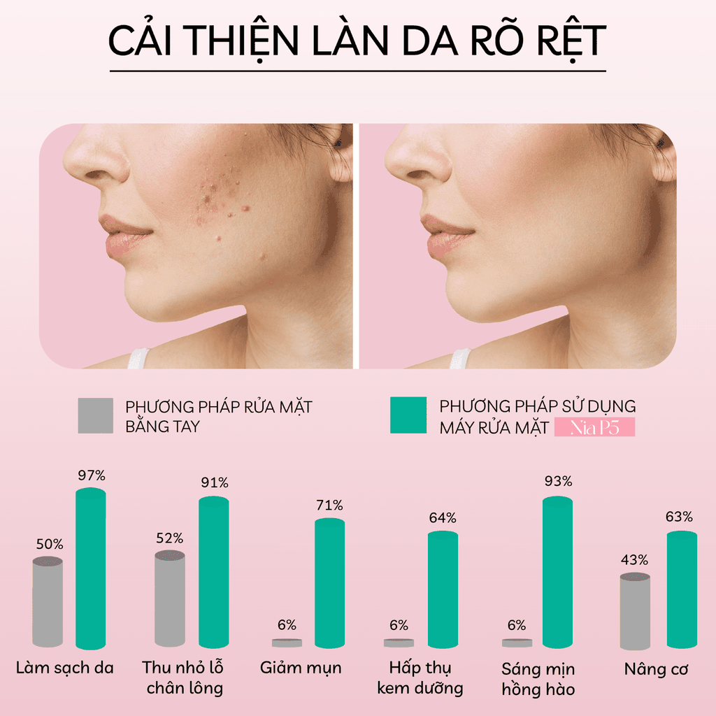 Máy Rửa Mặt Sóng Âm CRENOT NIA P5