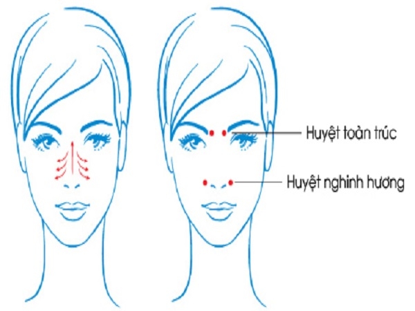 Chăm sóc và hỗ trợ điều trị viêm mũi xoang tại nhà