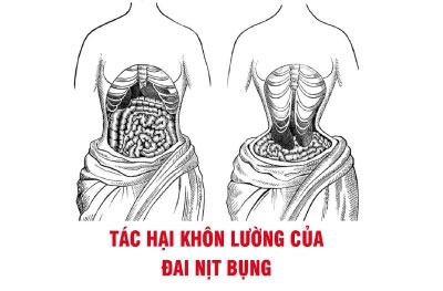 dai-nit-bung-tuong-an-toan-ma-hai-vo-cung