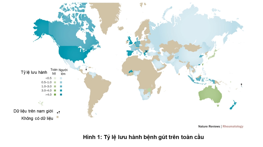 tinh-trang-benh-gout-tren-the-gioi-va-viet-nam