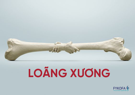 loang-xuong-dieu-tri-va-du-phong-hop-ly-cho-benh-nhan
