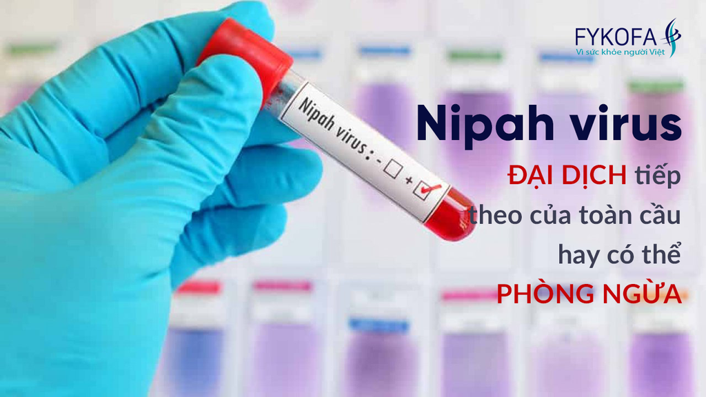 virus-nipah-dai-dich-tiep-theo-cua-toan-cau-hay-co-the-phong-ngua