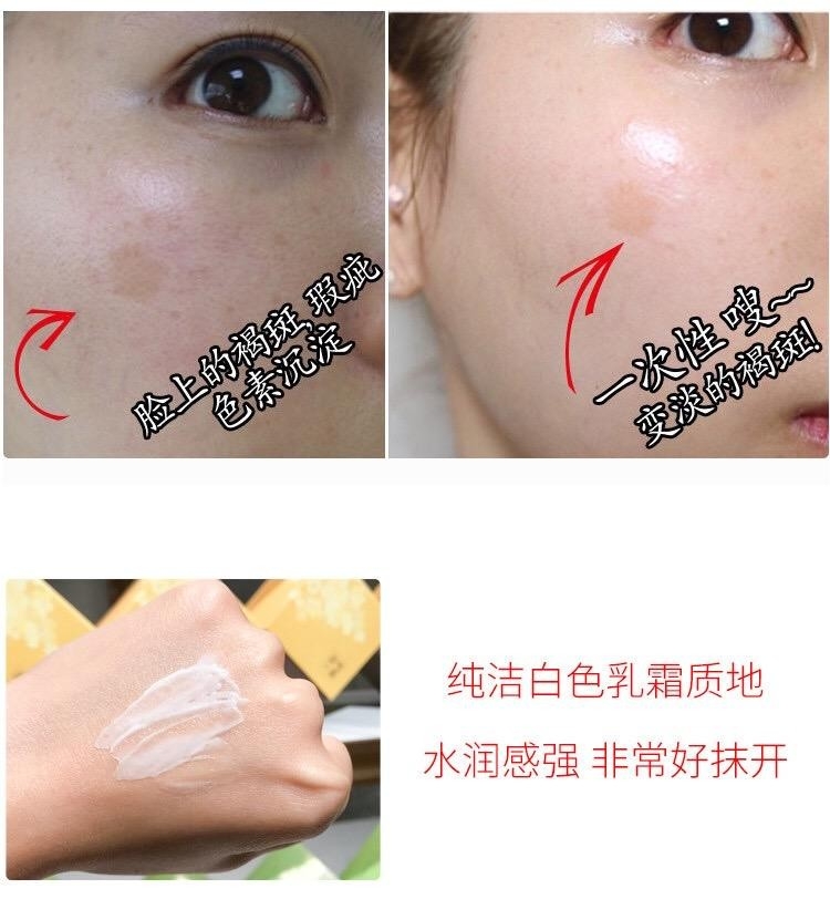 Kem Đặc Trị Nám Medi-Peel Melanon Cream 30ml