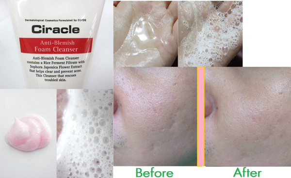 Sữa Rửa Mặt Ciracle Anti Blemish 150ml