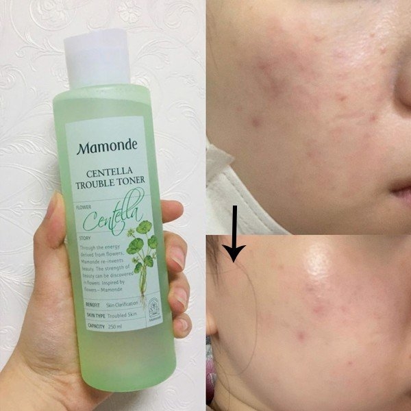 Nước Cân Bằng Chiết Xuất Rau Má Mamonde Centella Trouble Toner 250ml