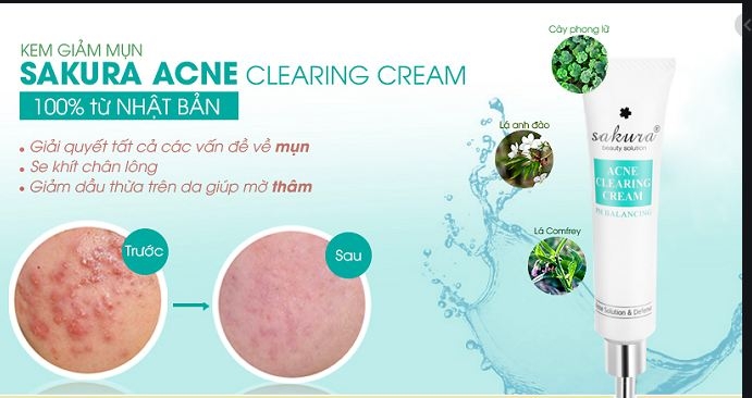 Kem Đặc Trị Mụn Và Giảm Dầu Nhờn Sakura Acne Clearing Cream 25g