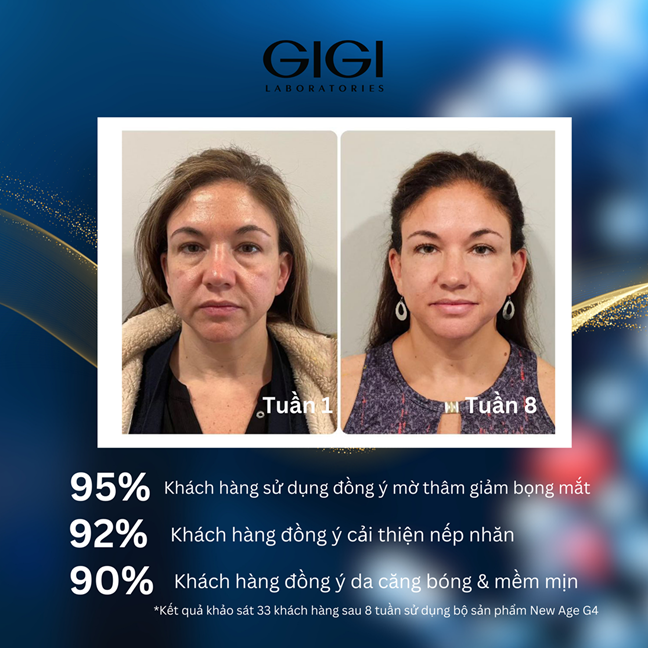 KEM DƯỠNG MẮT GIGI NEW AGE G4 EYE CREAM