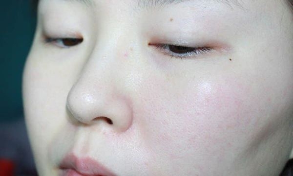 Serum trẻ hóa chuyên sâu vitamin C 17% Dr.Different Ph.D