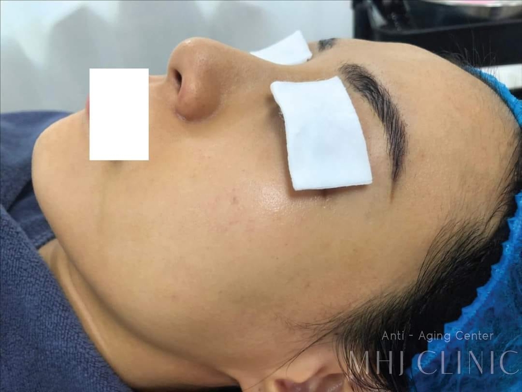 GIGI Challenging Anti Aging Treatment - Thách Thức Mọi Dấu Hiệu Lão Hóa