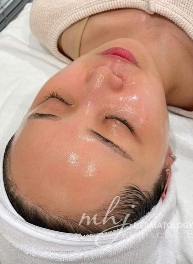 GIGI Glow Up Treatment - Siêu Căng Bóng Trẻ Hóa