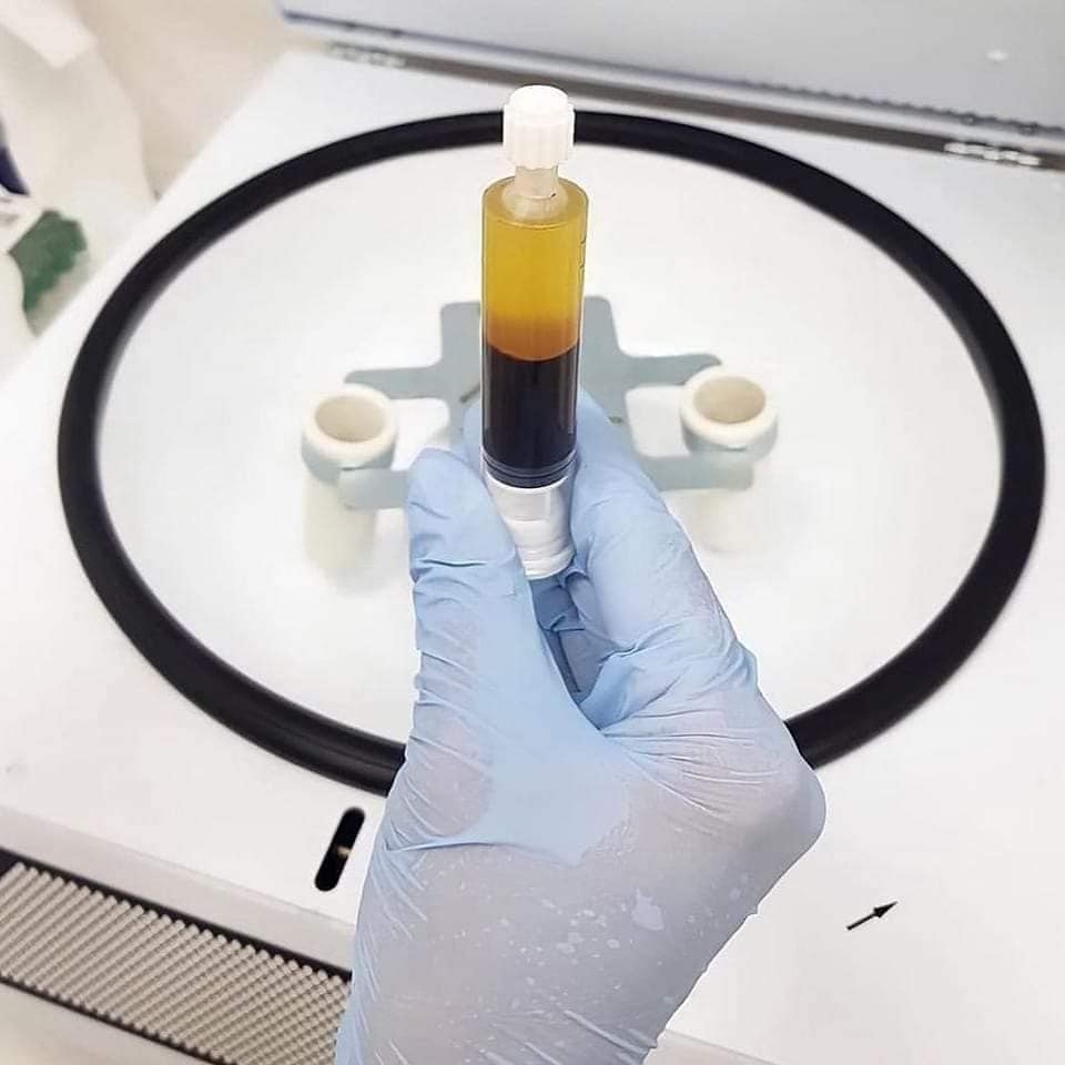 PRP (Platelet-Rich Plasma) - Phương pháp trẻ hóa và tái tạo tế bào cho làn da hoàn hảo