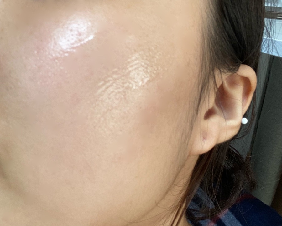 Serum cấp ẩm dịu da Volayon Hyaloten Serum