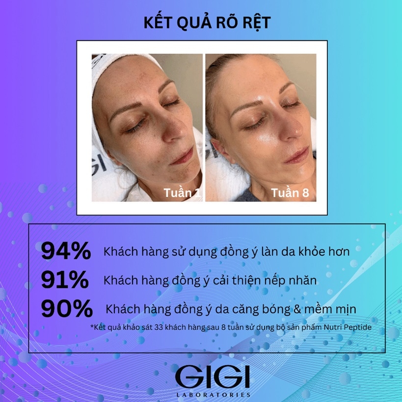 Kem AHA trẻ hóa tái tạo sáng da GIGI LABORATORIES Nutri Peptide Glycolic 10% 50ml