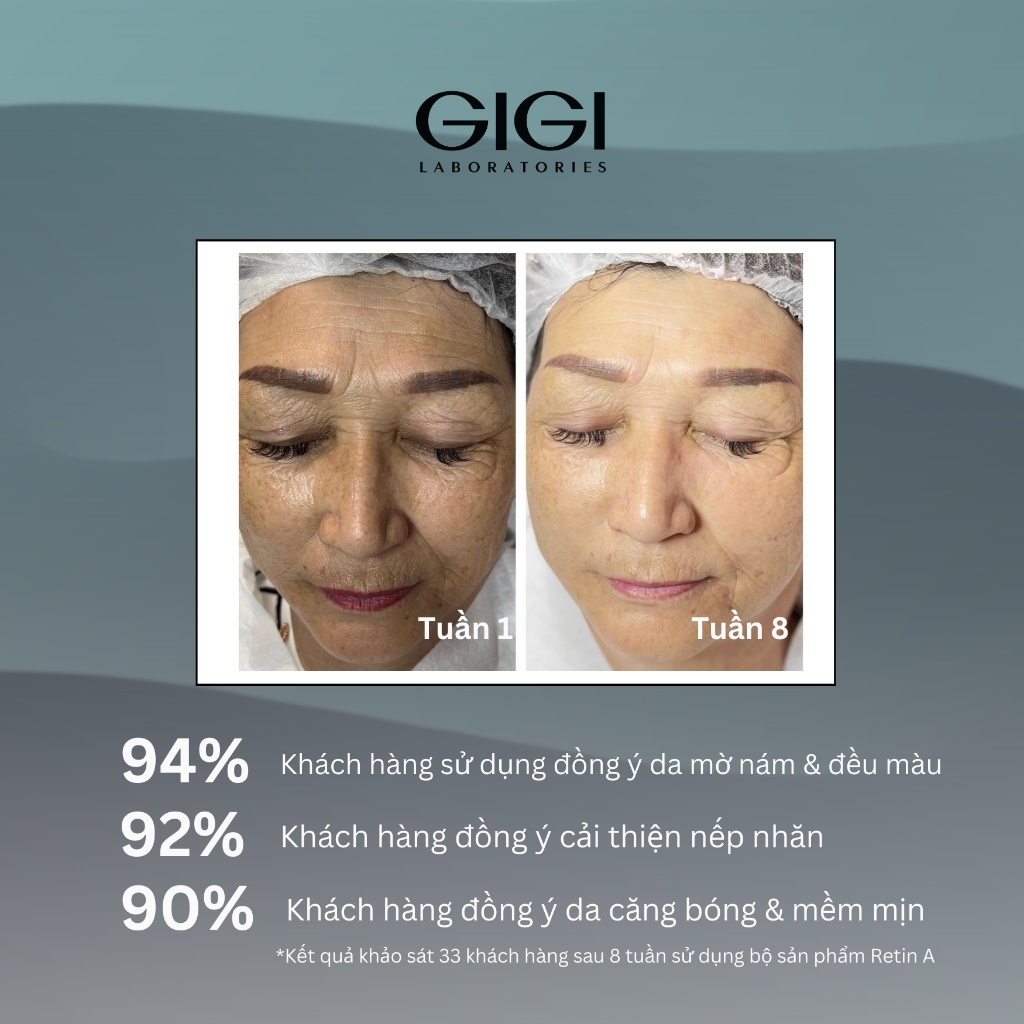 Kem giảm sạm nám sáng da GIGI LABORATORIES RETIN A MELANO BLOCK 30ml