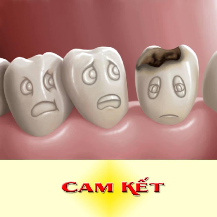 ​​​​​​​Sâu răng nặng vào tủy và những giải pháp chữa trị kịp thời