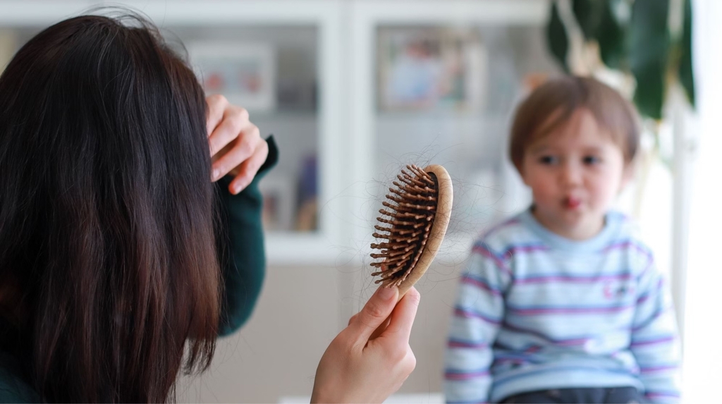 Cách khắc phục rụng tóc sau sinh hiệu quả