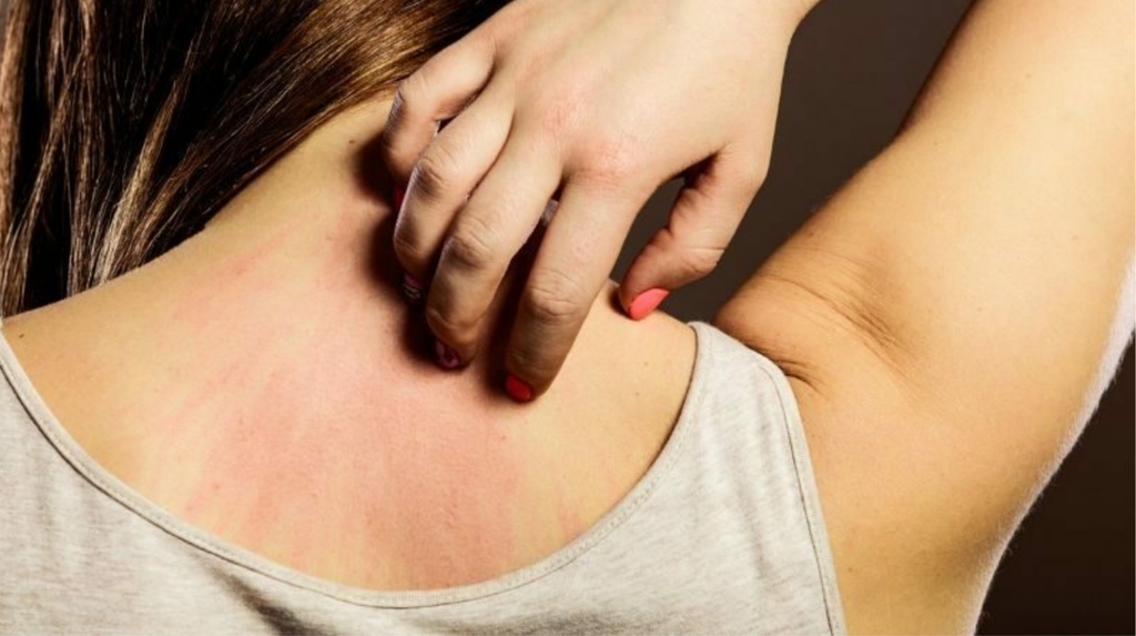 Một số dấu hiệu tổn thương gan trên da