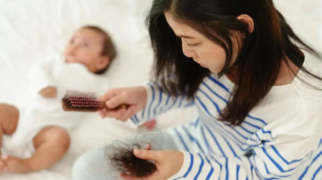 Một số sai lầm phổ biến khi xử lý rụng tóc sau sinh