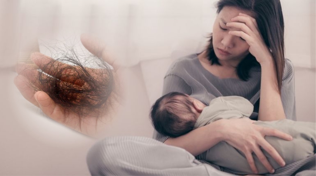 Rụng tóc sau sinh là gì? Có đáng lo không?