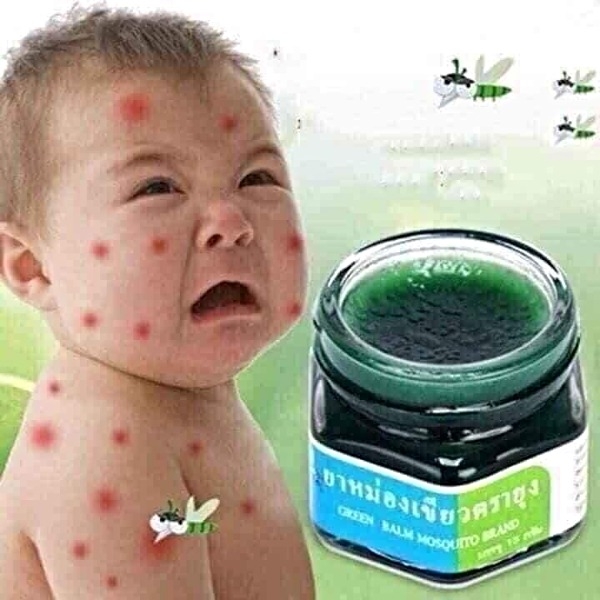Dầu thoa trị muỗi đốt Green Blam Mosquito Brand 13g