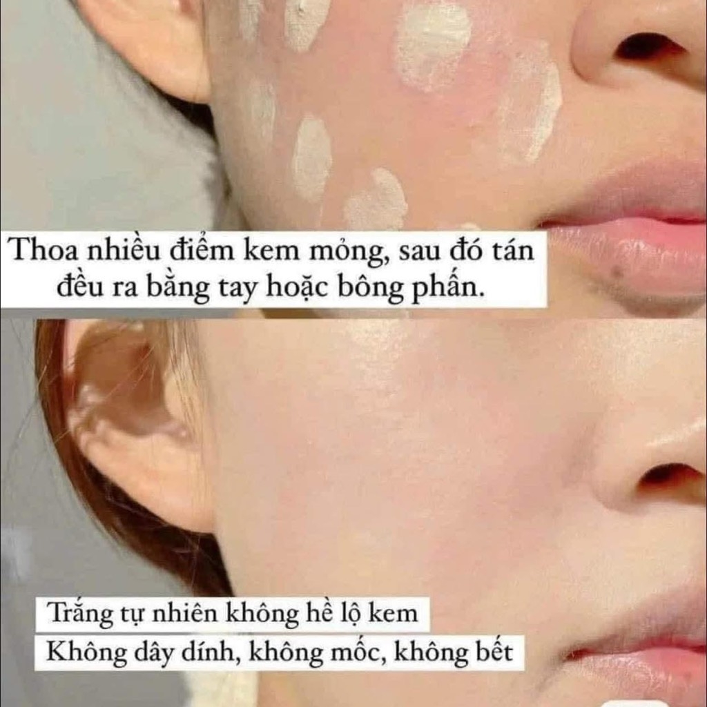 KEM CHE KHUYẾT ĐIỂM TREECHADA XỊN (15)